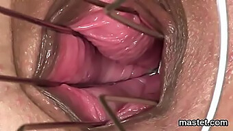 A Unique Czech Woman Extends Her Constricted Vagina With A Particular Device